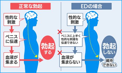 勃起 放置|勃起不全の原因と改善策とは？EDのタイプ・原因を。